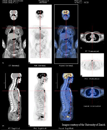 Diagnostica